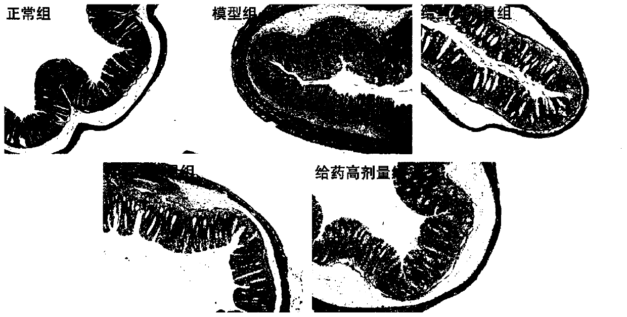 Application of atractylodes macrocephala polysaccharide in preparation of drug for preventing and treating ulcerative colitis