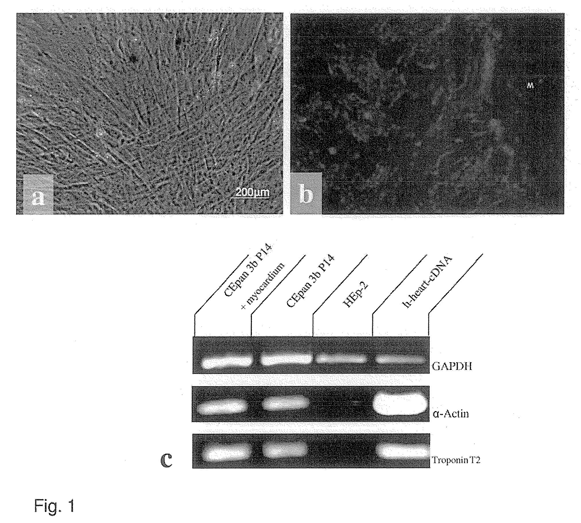 Method for producing autonomously contracting cardiac muscle cells from adult stem cells, in particular human adult stem cells