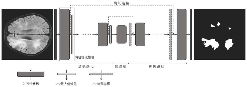 Children brain MRI demyelination focus positioning method based on deep semi-supervised segmentation