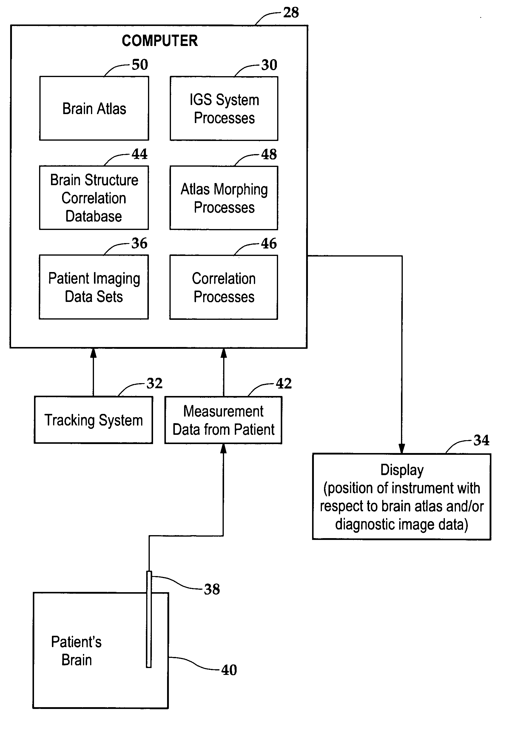 Neurosurgery targeting and delivery system for brain structures