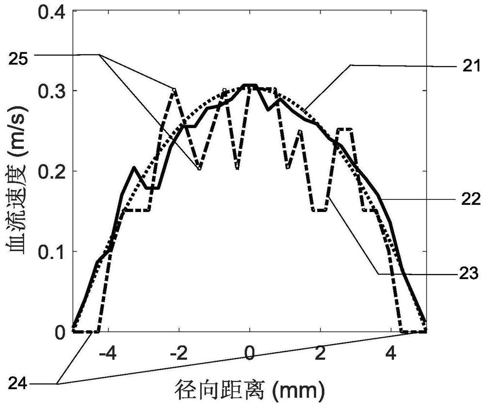 An Optimal Frame Interval Tracking Estimation for Ultrasound Velocity Field Measurement