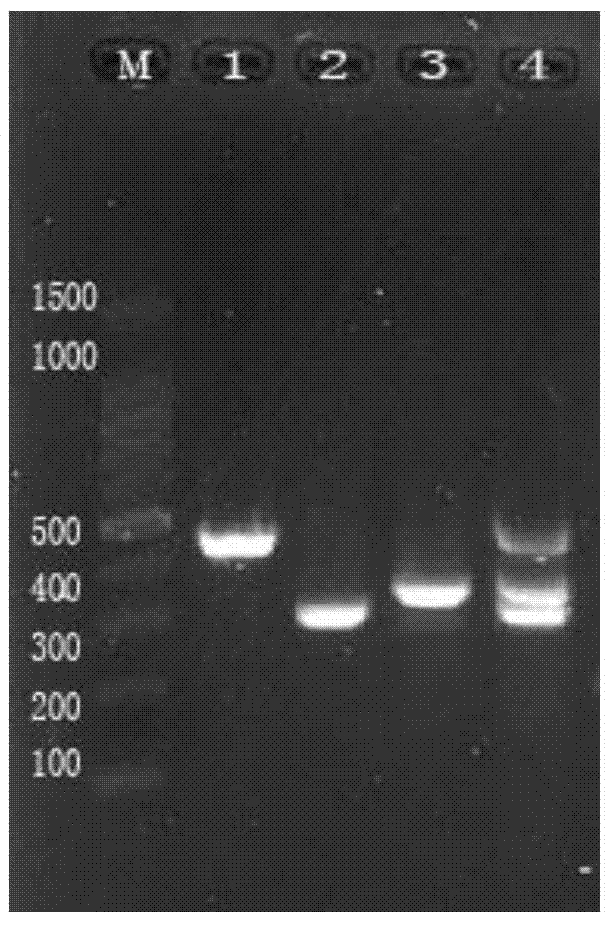 Kit for detecting infectious laryngotracheitis virus, newcastle disease virus and infectious bronchitis virus