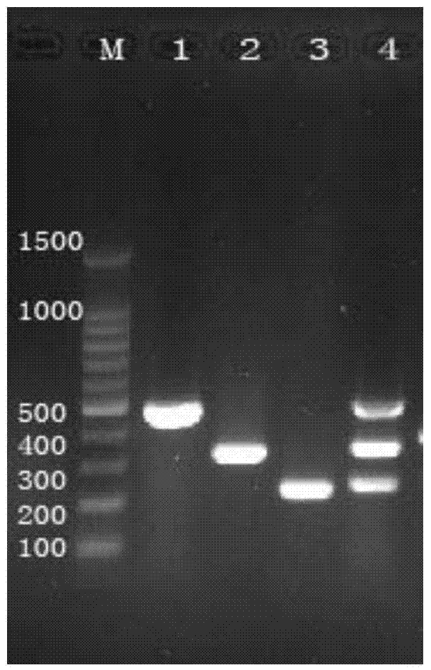 Kit for detecting infectious laryngotracheitis virus, newcastle disease virus and infectious bronchitis virus