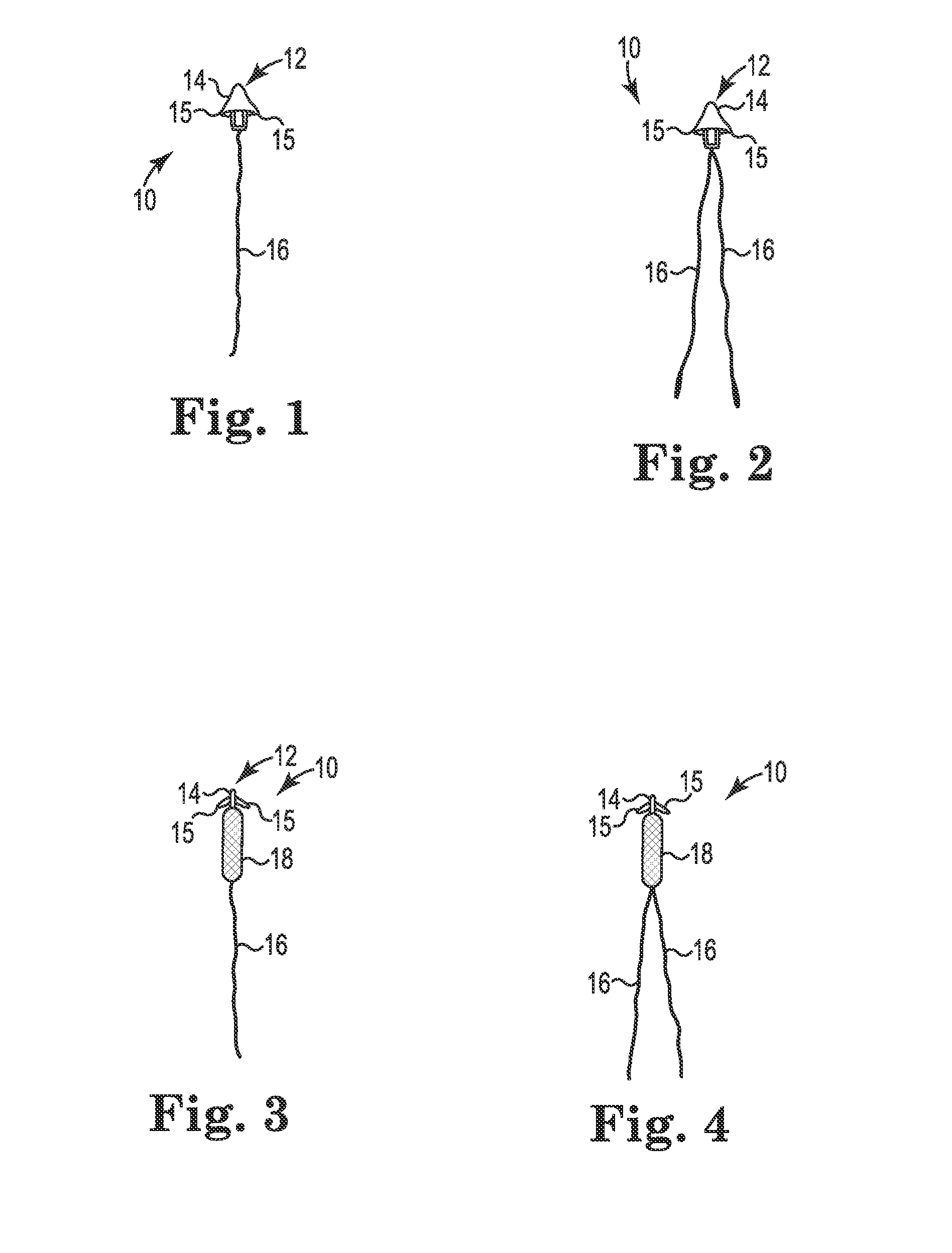 Transperitoneal prolapse repair system and method