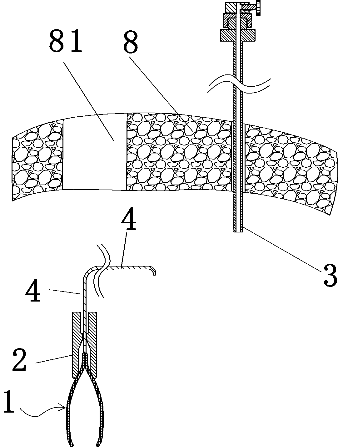 Minimally invasive surgery clamp for abdominal cavity