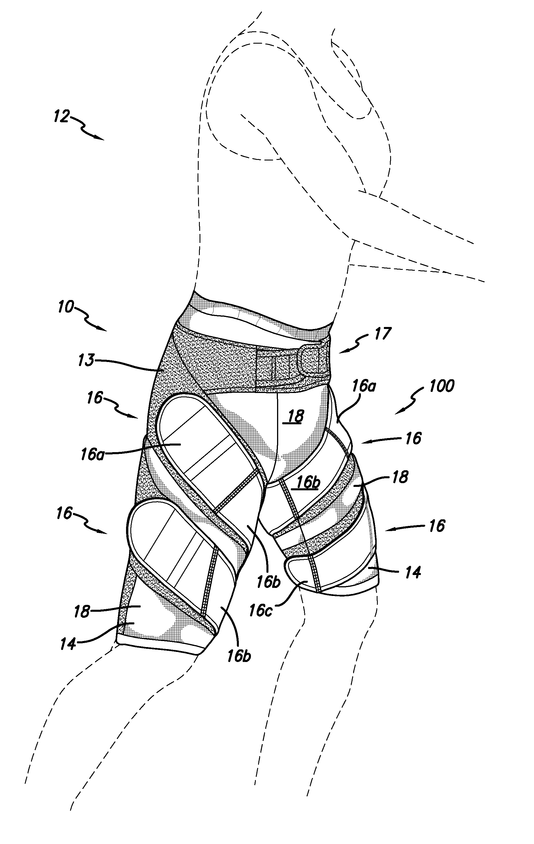 Posture improving garment