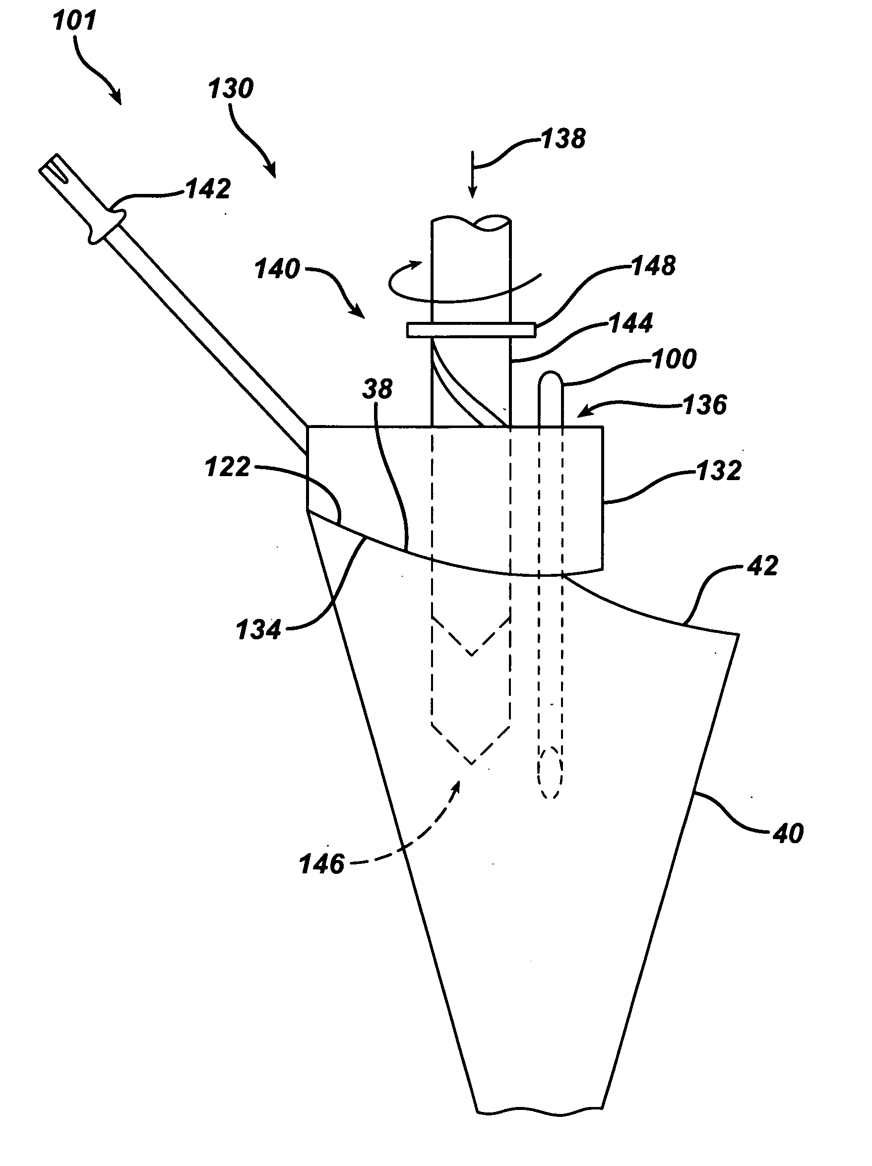 Instrument for preparing an implant support surface and associated method