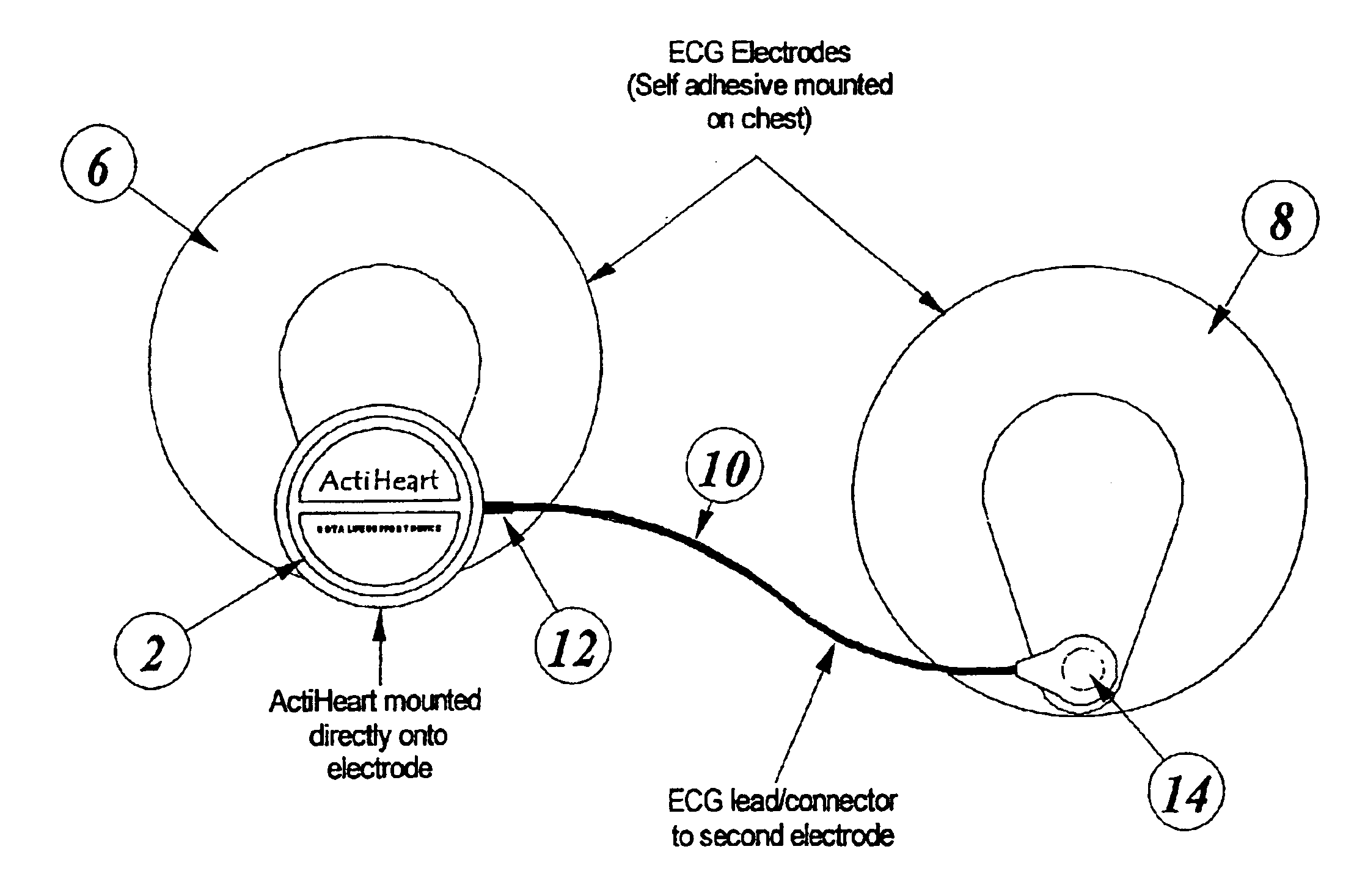 Cardiac monitoring apparatus and method