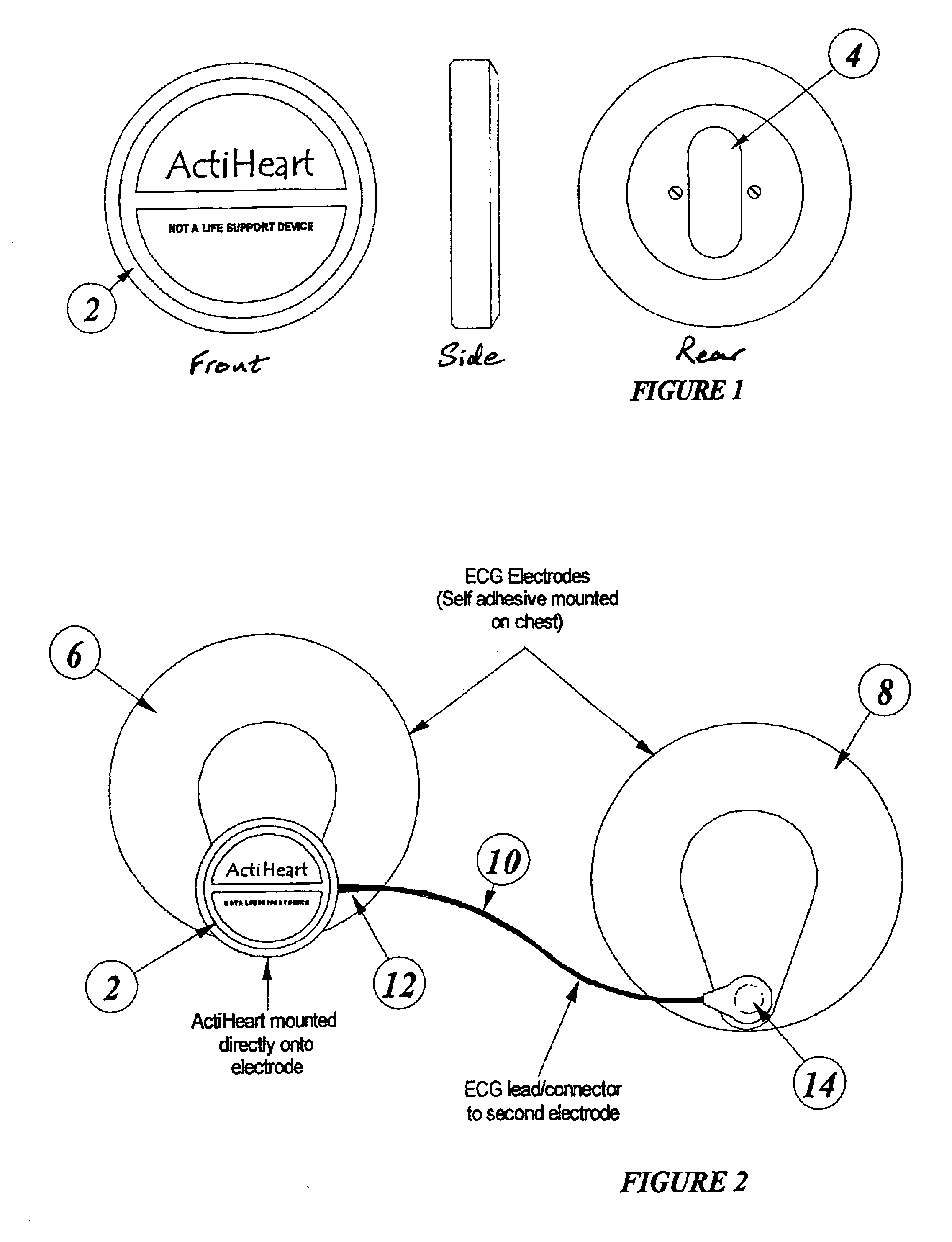 Cardiac monitoring apparatus and method