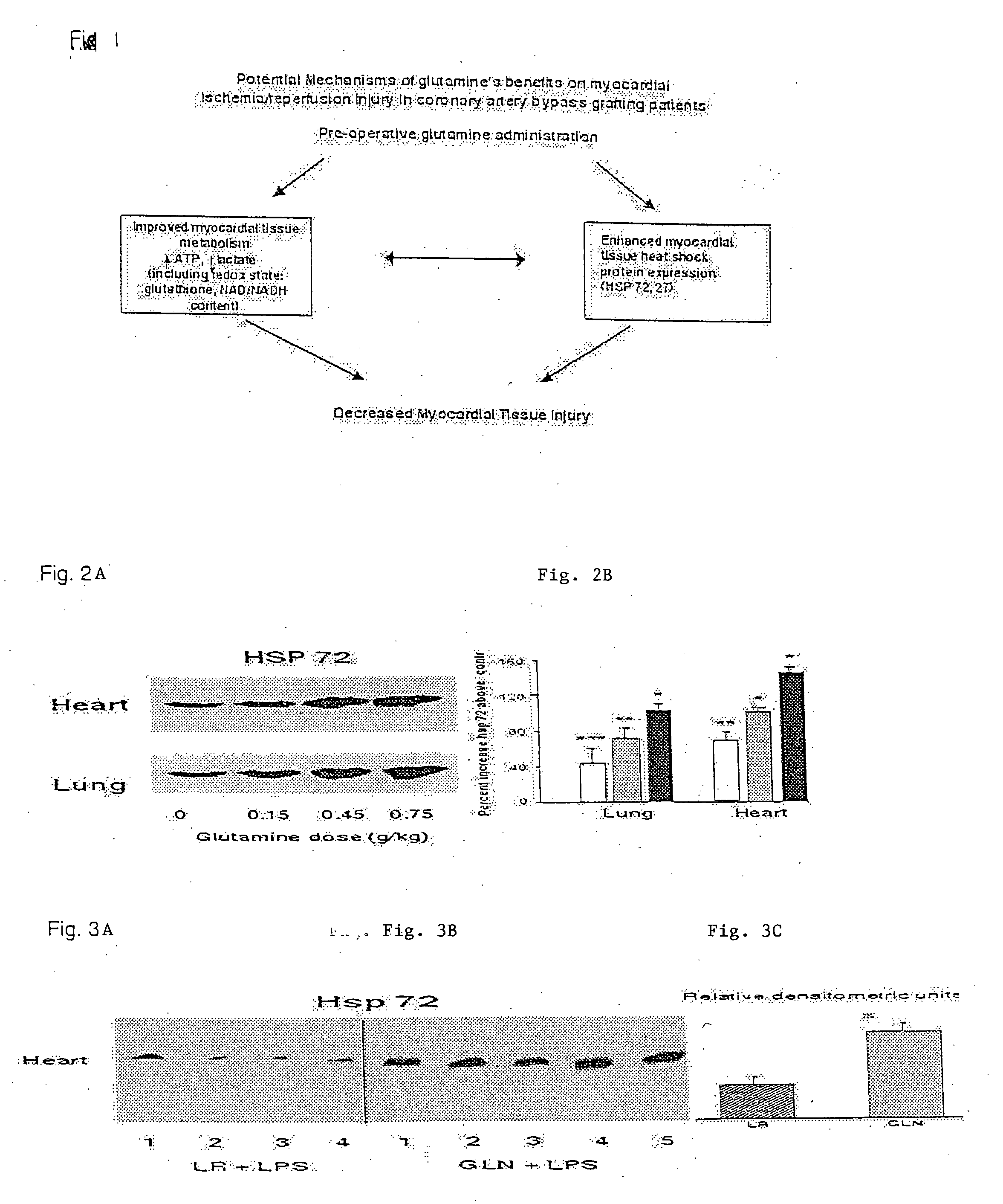 Glutamine for use in treating injury