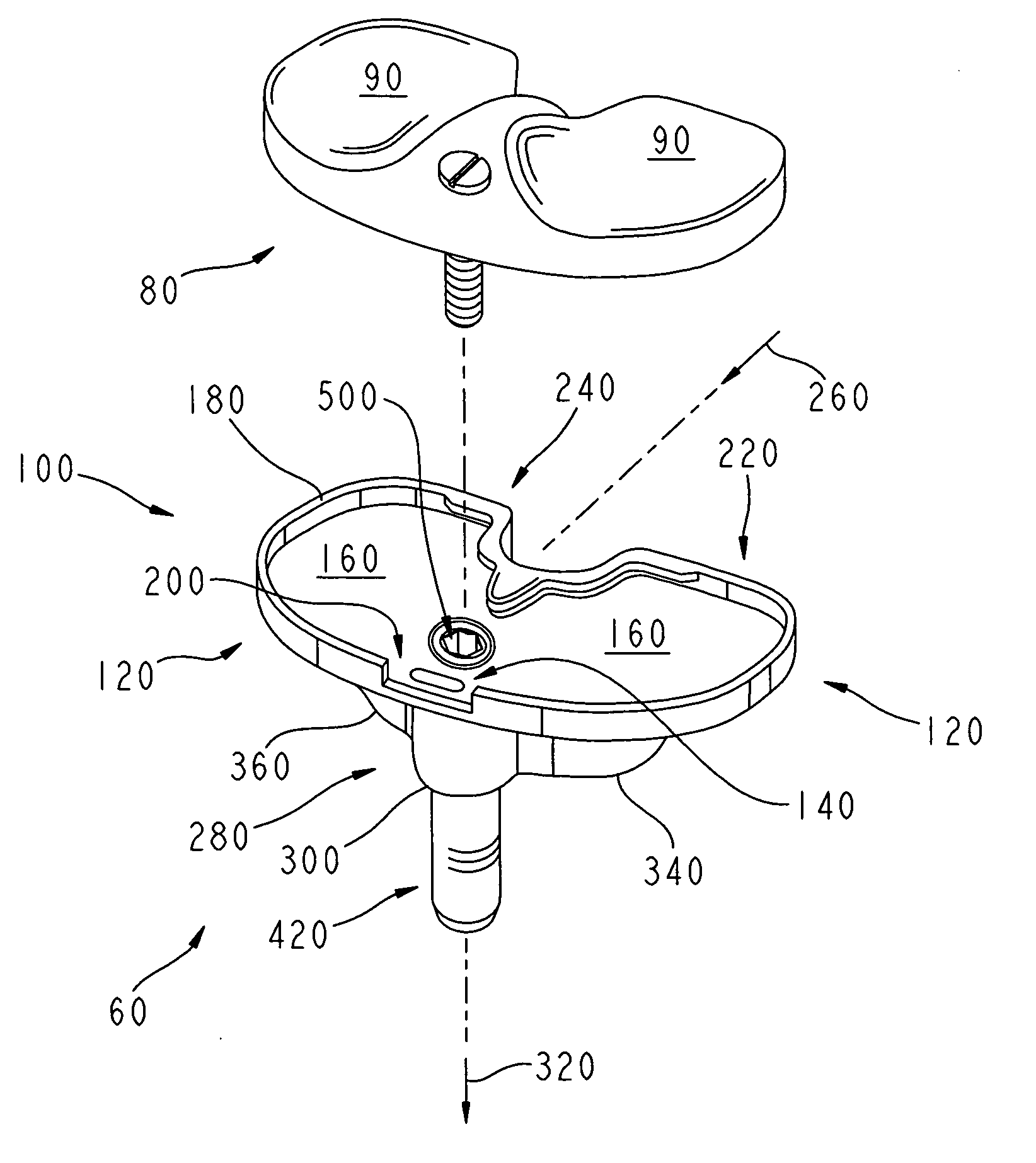 Tibial implant with a through post