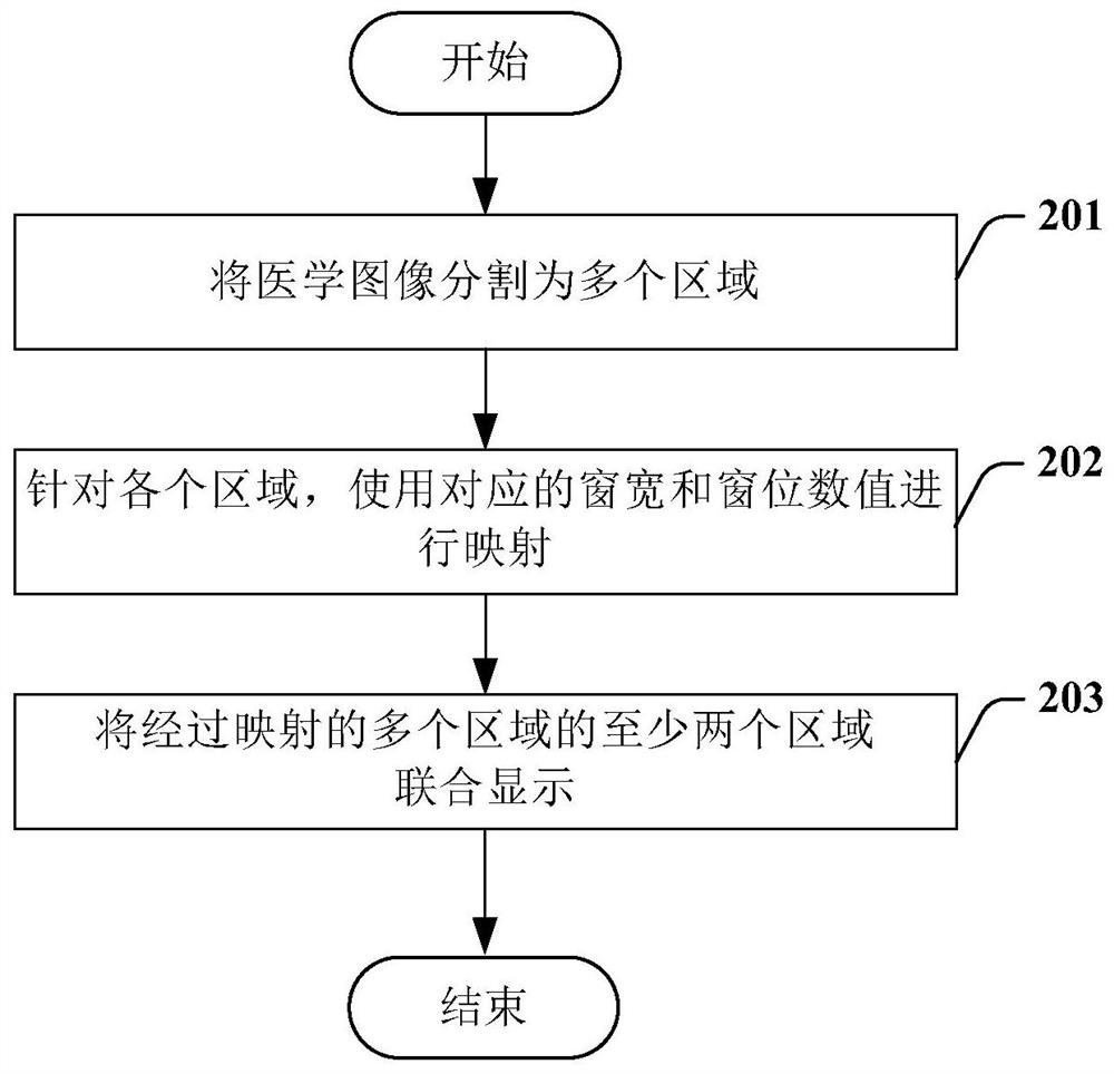 Medical image display method, device and computer storage medium