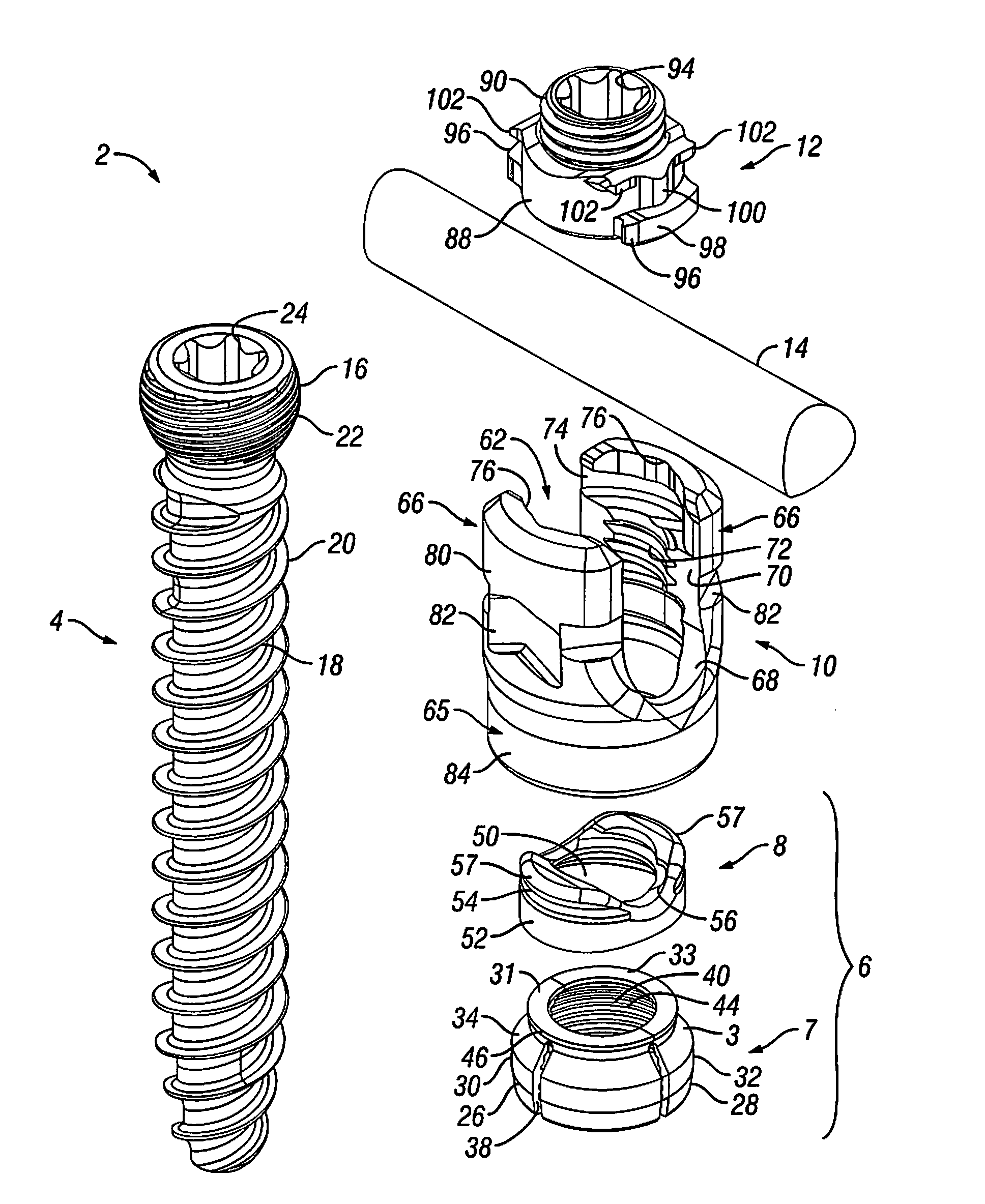 Orthopedic Fixation Devices and Methods of Installation Thereof