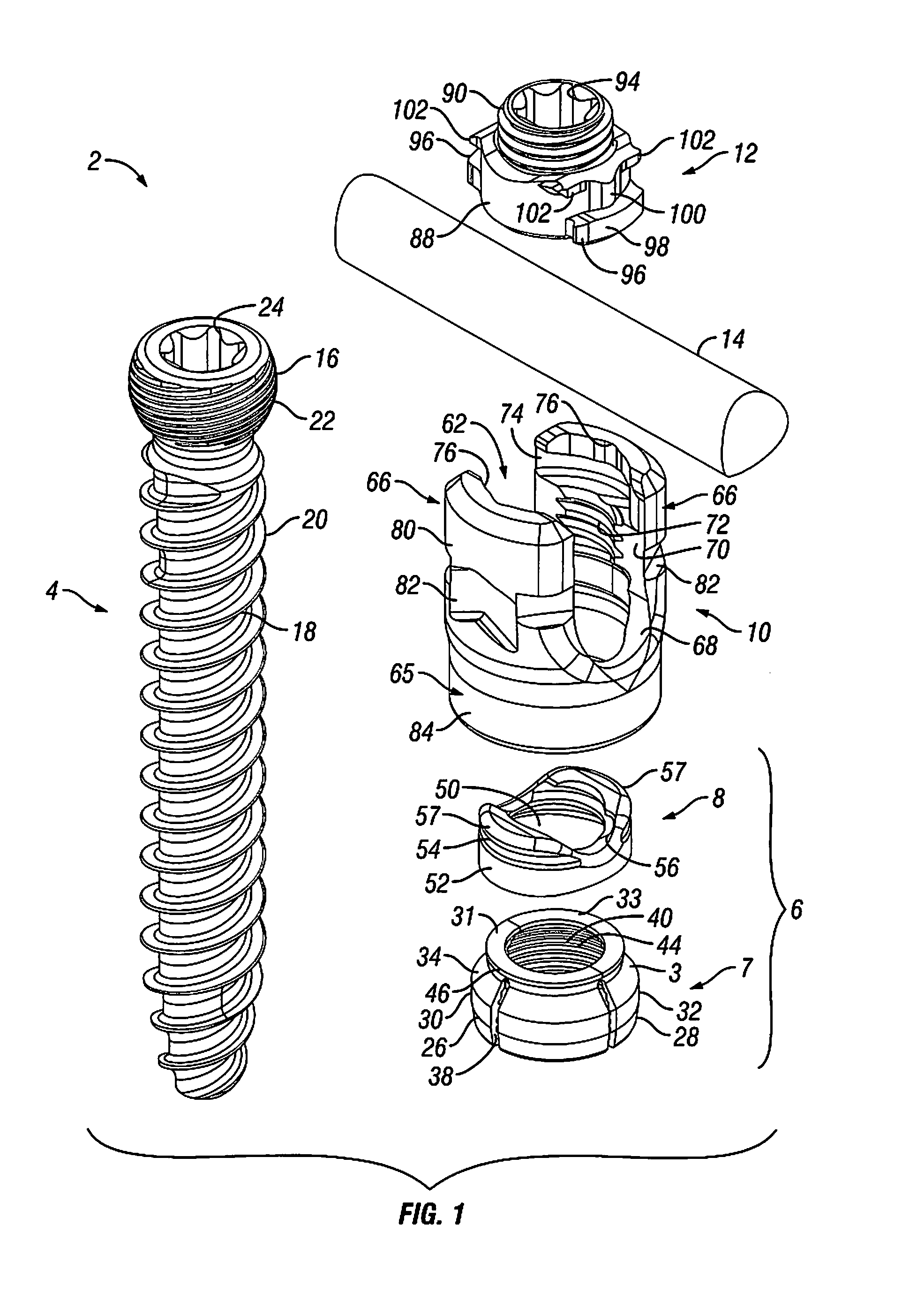 Orthopedic Fixation Devices and Methods of Installation Thereof