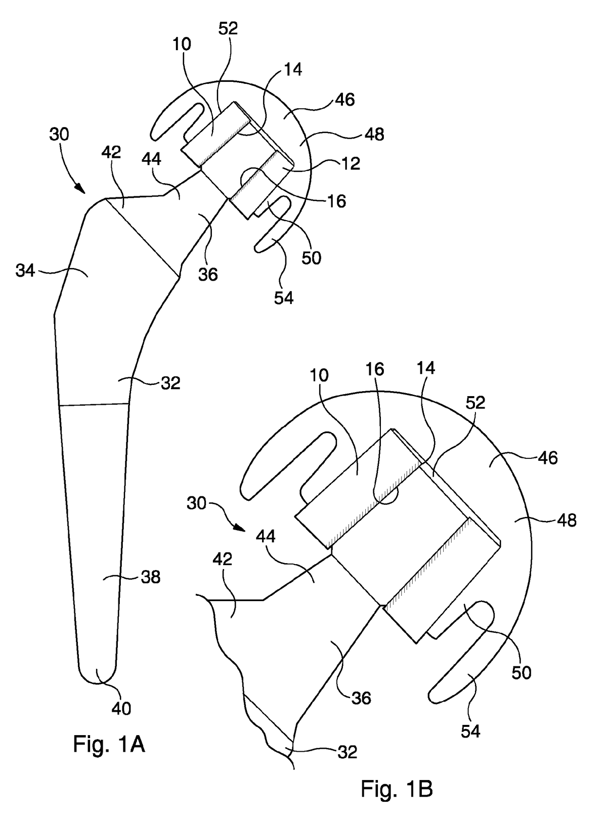 Prosthesis having a large femoral head