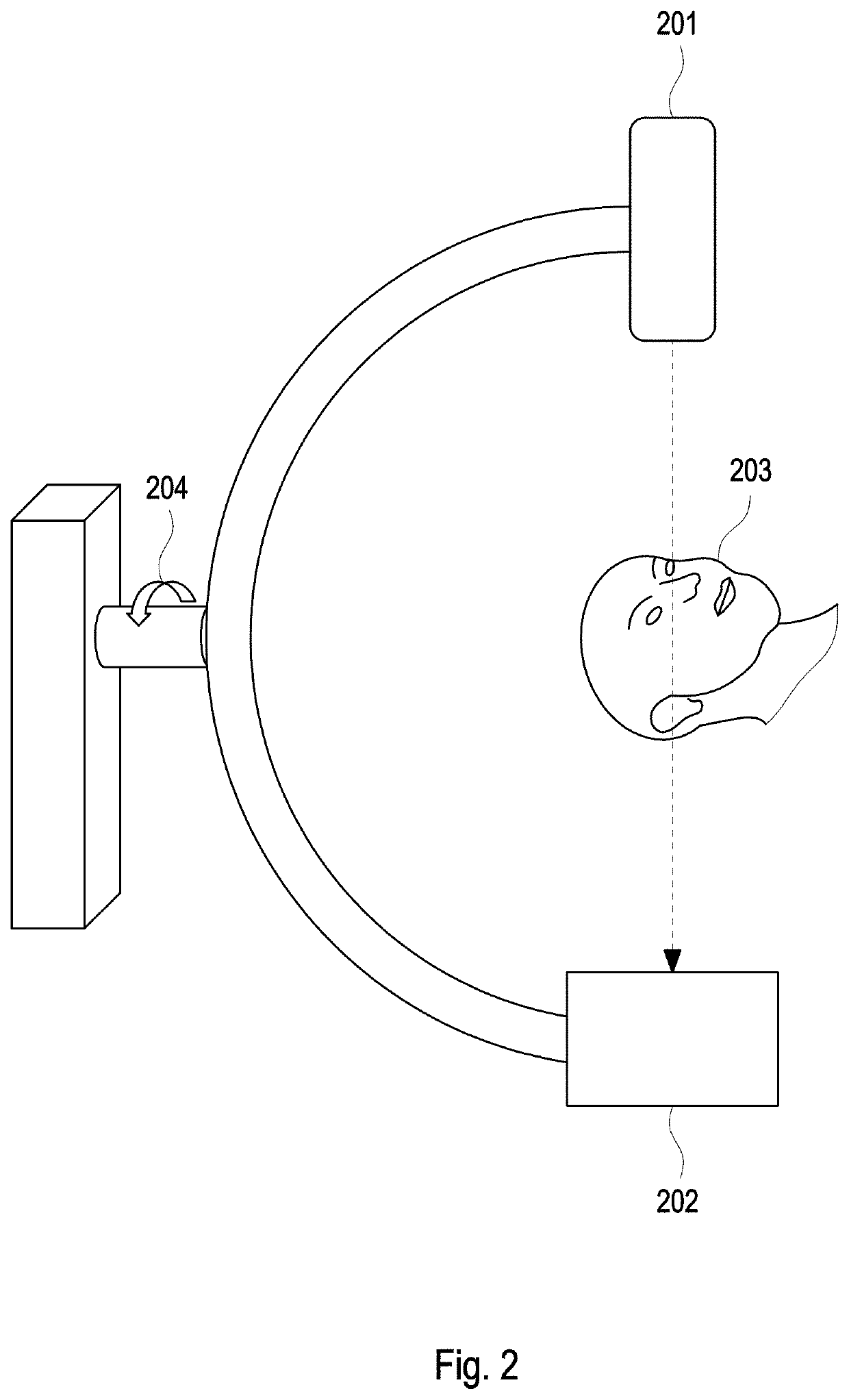 Method and system for 4D radiological intervention guidance (4D-cath)