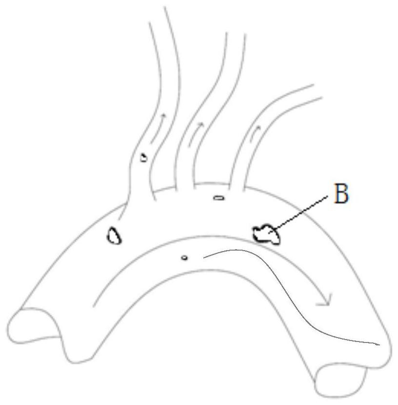 Embolus redirector and conveying device thereof