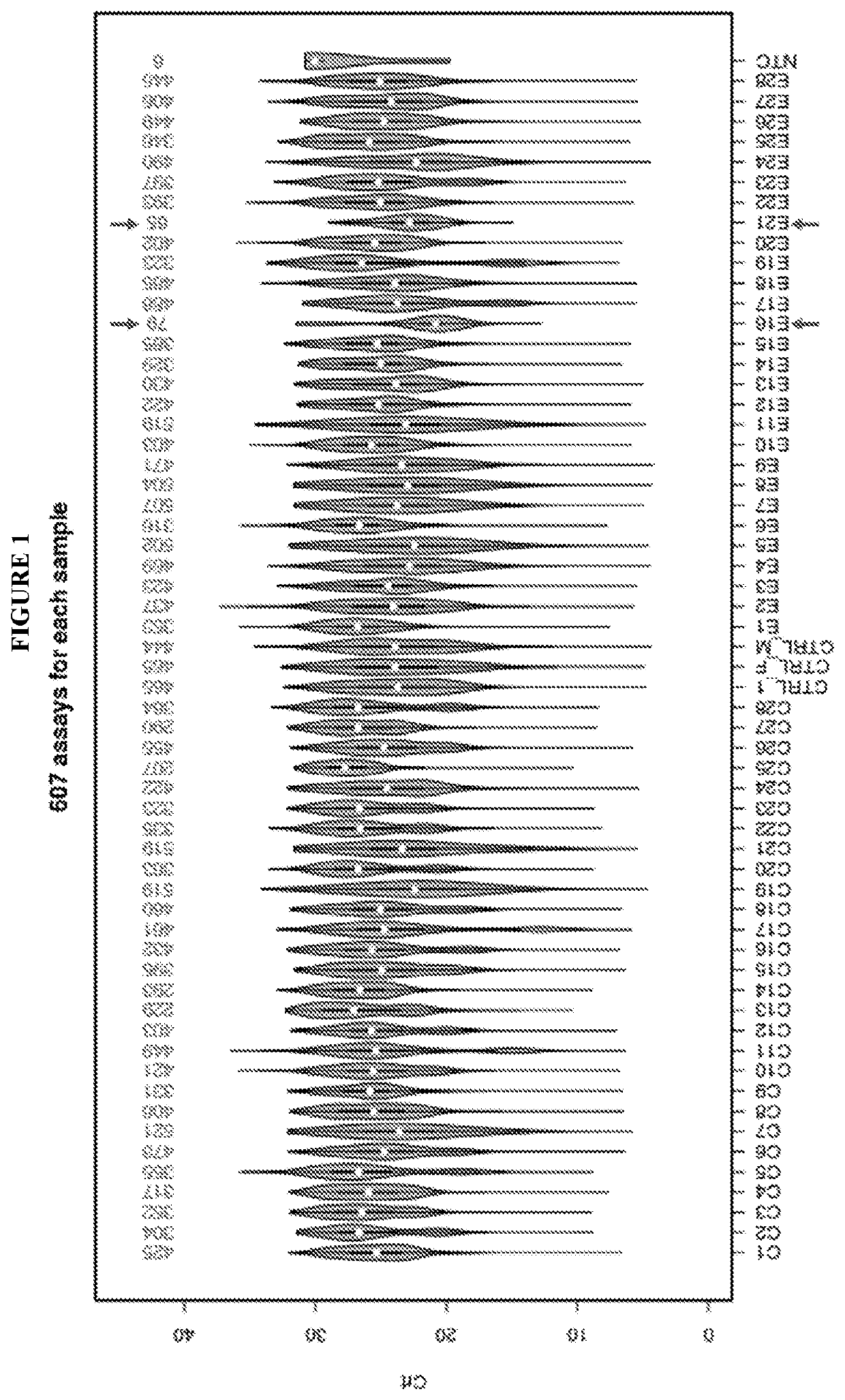 Profiling microvesicle nucleic acids and uses thereof as signatures in diagnosis of renal transplant rejection