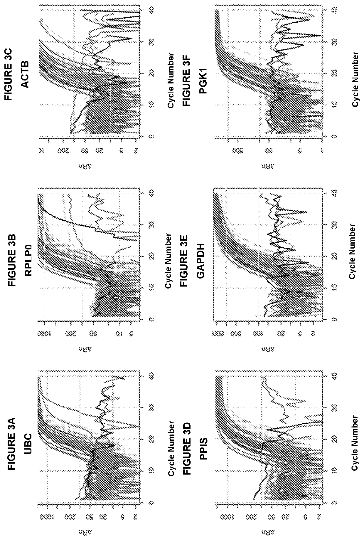 Profiling microvesicle nucleic acids and uses thereof as signatures in diagnosis of renal transplant rejection