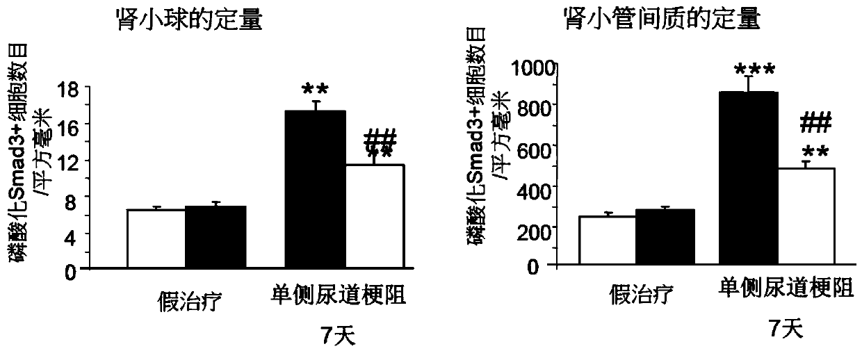 Application of dynein light chain roadblock-type 2 in preparation of medicine treating kidney failure and the medicine thereof