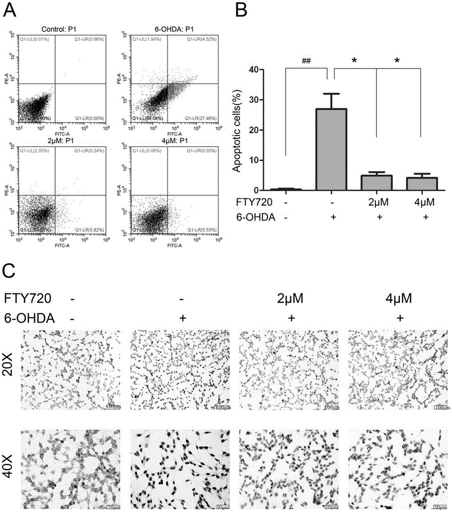 Novel applications of medicament Fingolimod