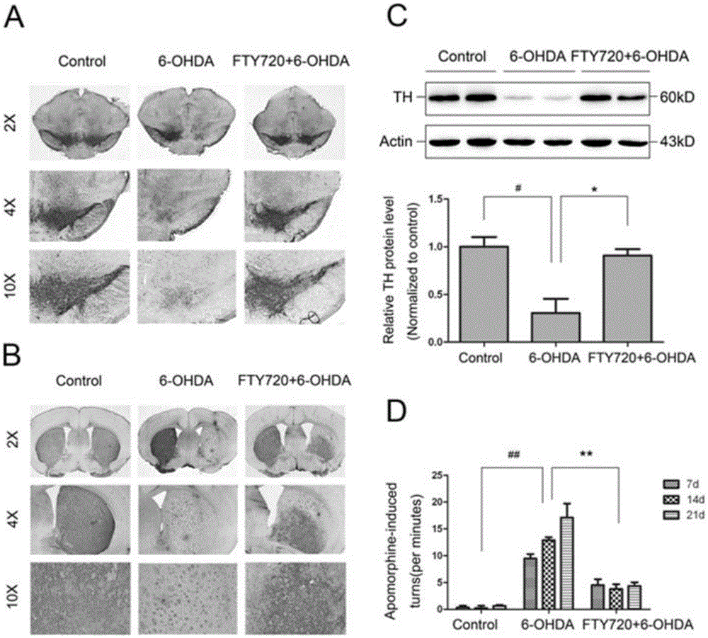 Novel applications of medicament Fingolimod