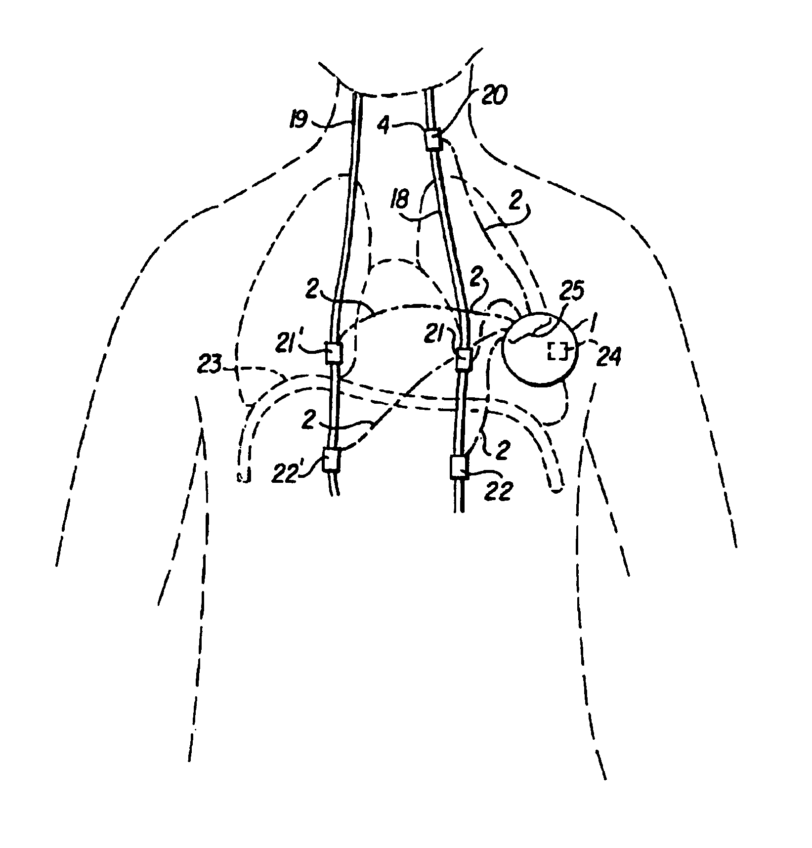 Modulation of drug effects by vagus nerve stimulation