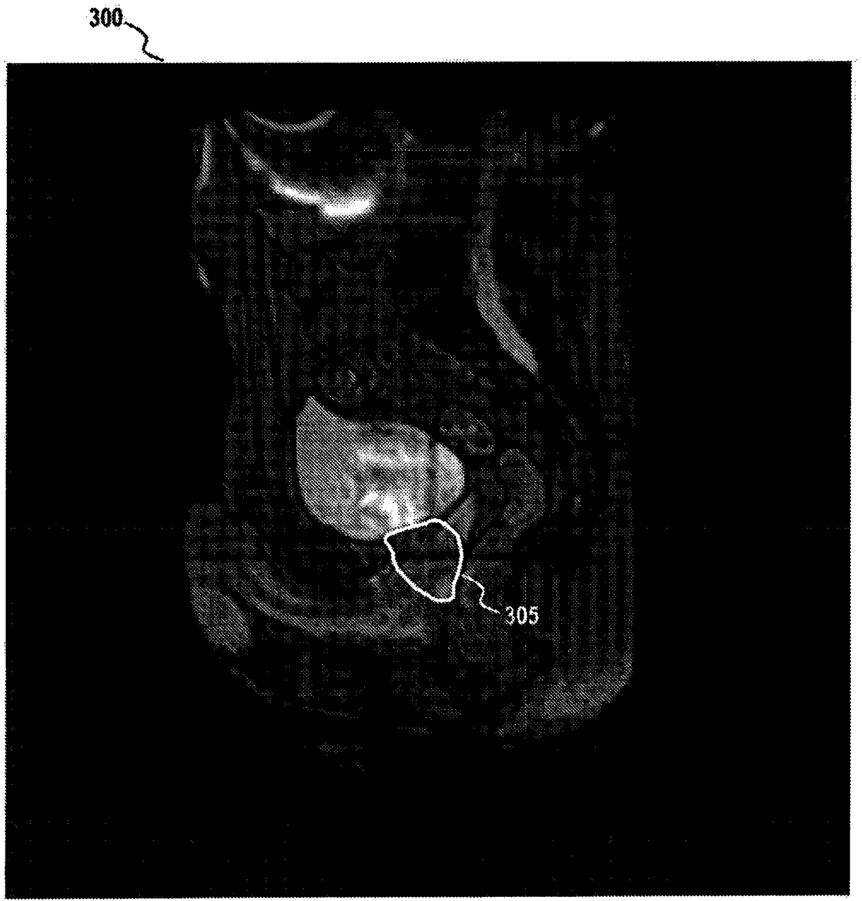 Motion management in image-guided radiotherapy