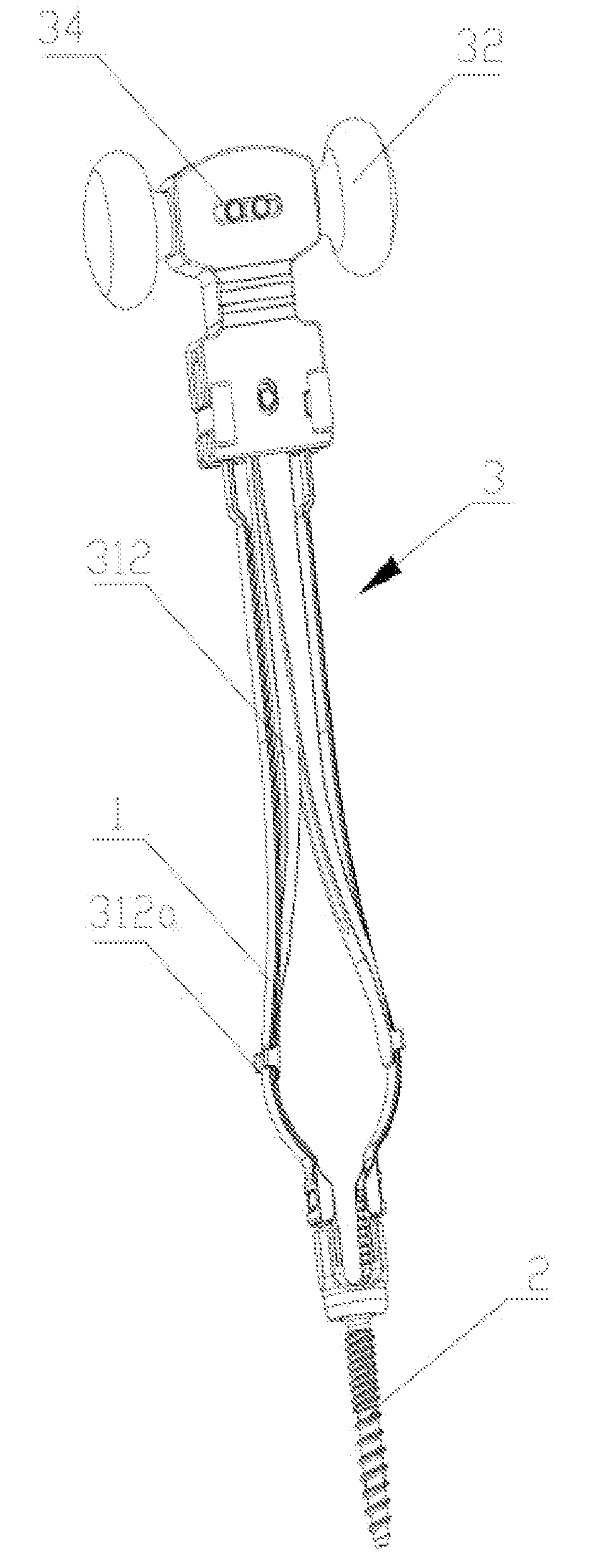 Extension piece at screw end of pedicle screw, dilator and push rod reset lever