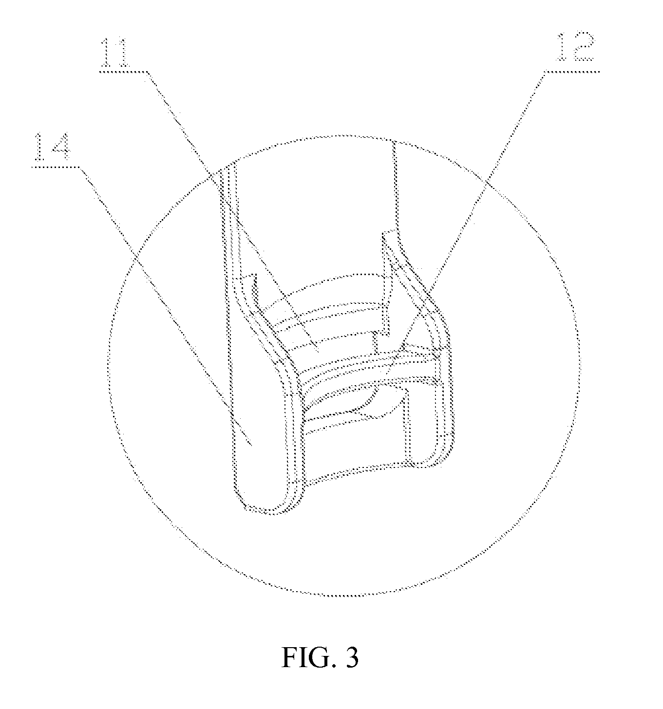 Extension piece at screw end of pedicle screw, dilator and push rod reset lever