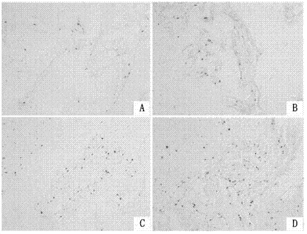 Channel ushering drug common achyranthes-containing traditional Chinese drug composition for improving bone marrow stem cell homing