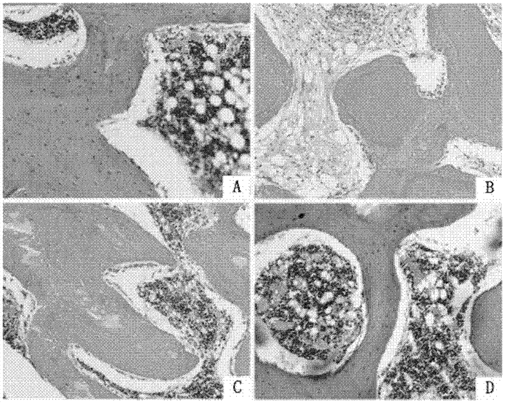 Channel ushering drug common achyranthes-containing traditional Chinese drug composition for improving bone marrow stem cell homing