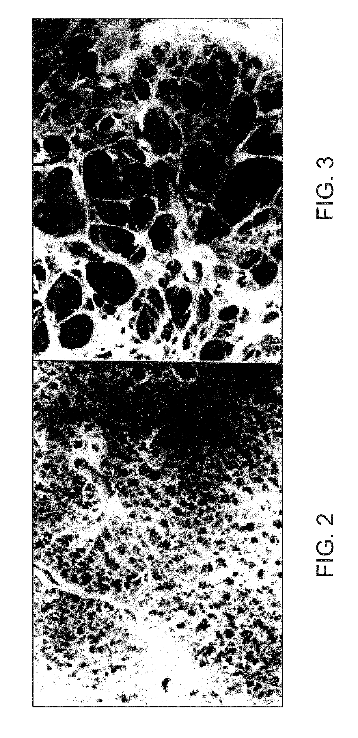 Devices, treatments and methods to restore tissue elastic recoil