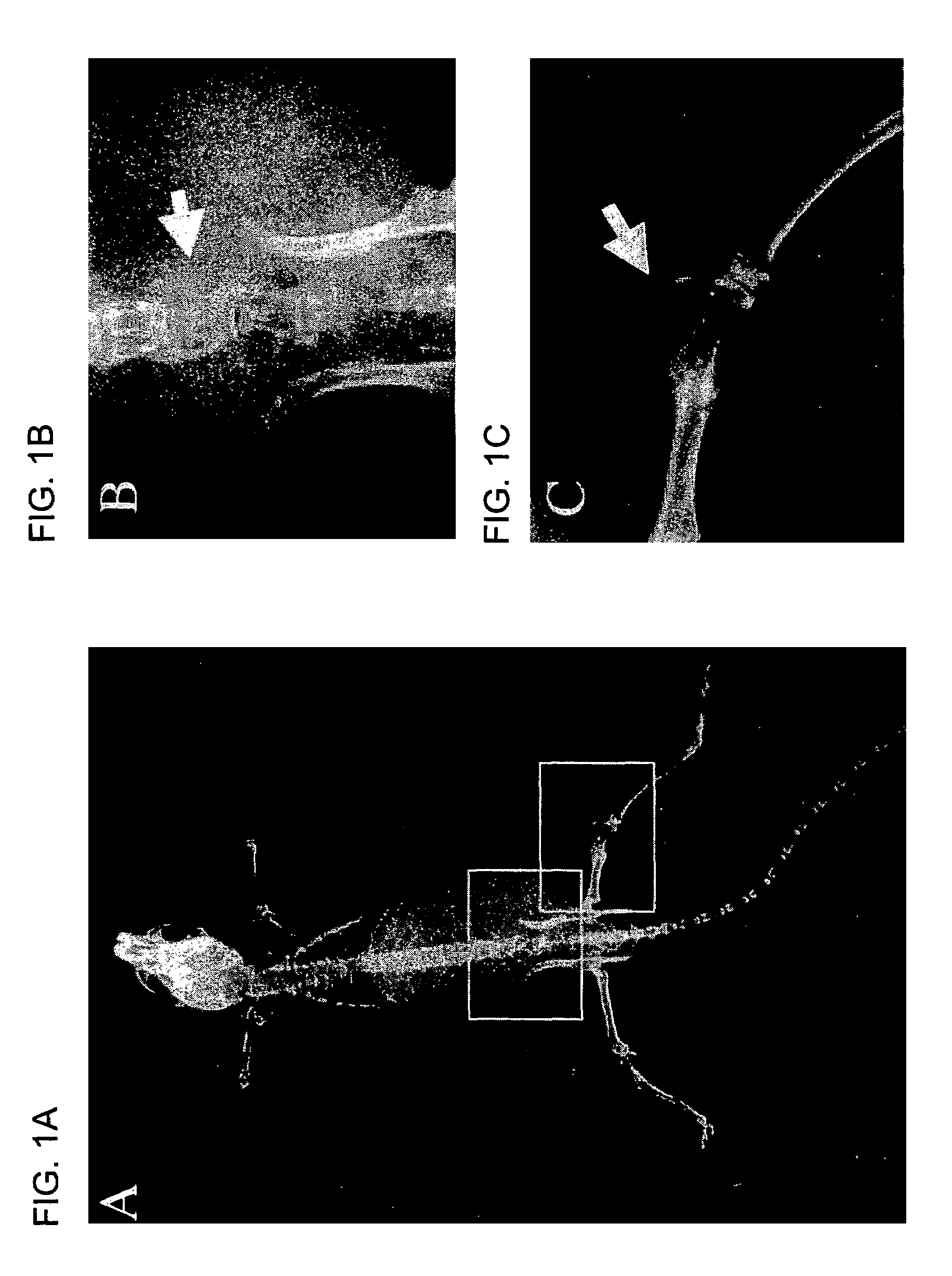 Non-human animal exhibiting bone metastasis of tumor cells and method of screening for bone metastasis inhibitors