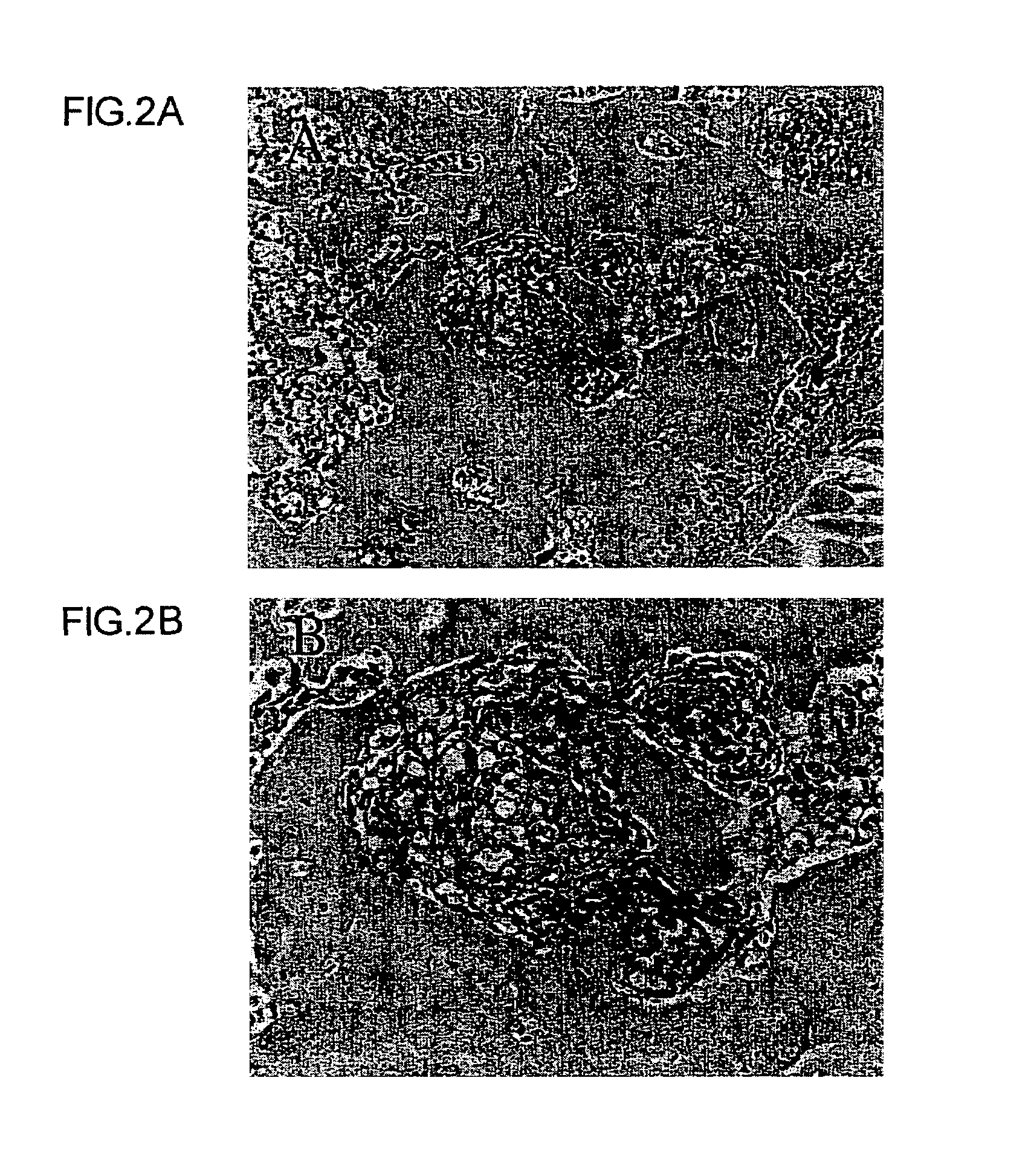 Non-human animal exhibiting bone metastasis of tumor cells and method of screening for bone metastasis inhibitors