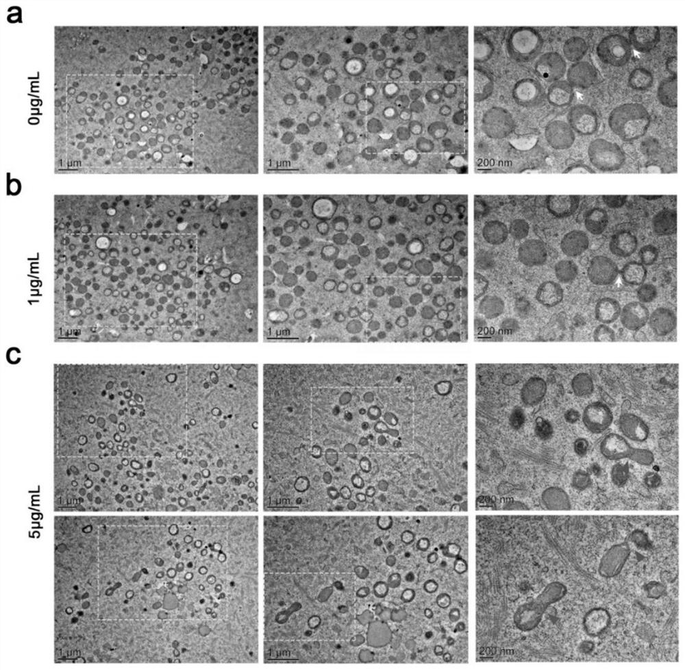 Improved micromanipulation liquid for mitochondrial replacement technology and preparation method of improved micromanipulation liquid