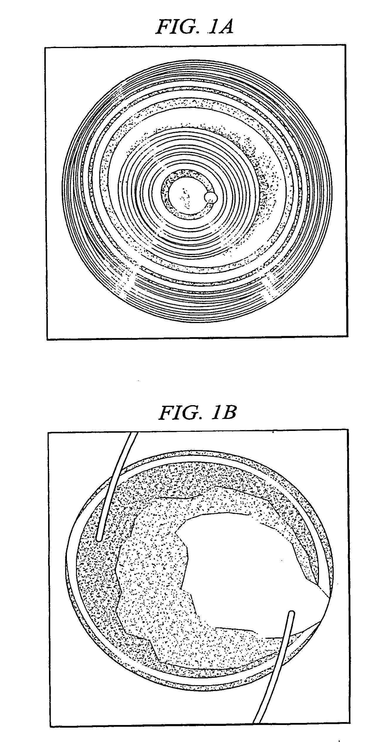 Light adjustable multifocal lenses