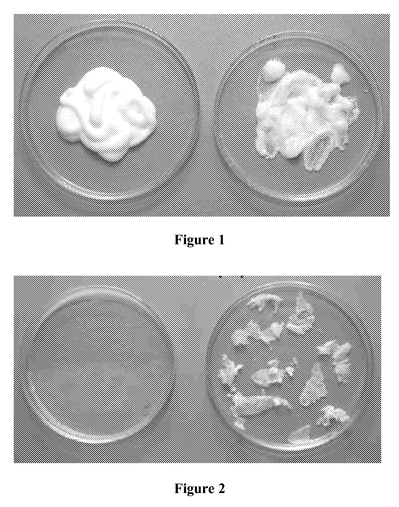 Medicinal Cream Made Using Fluticasone Propionate And Chitosan And A Process To Make The Same