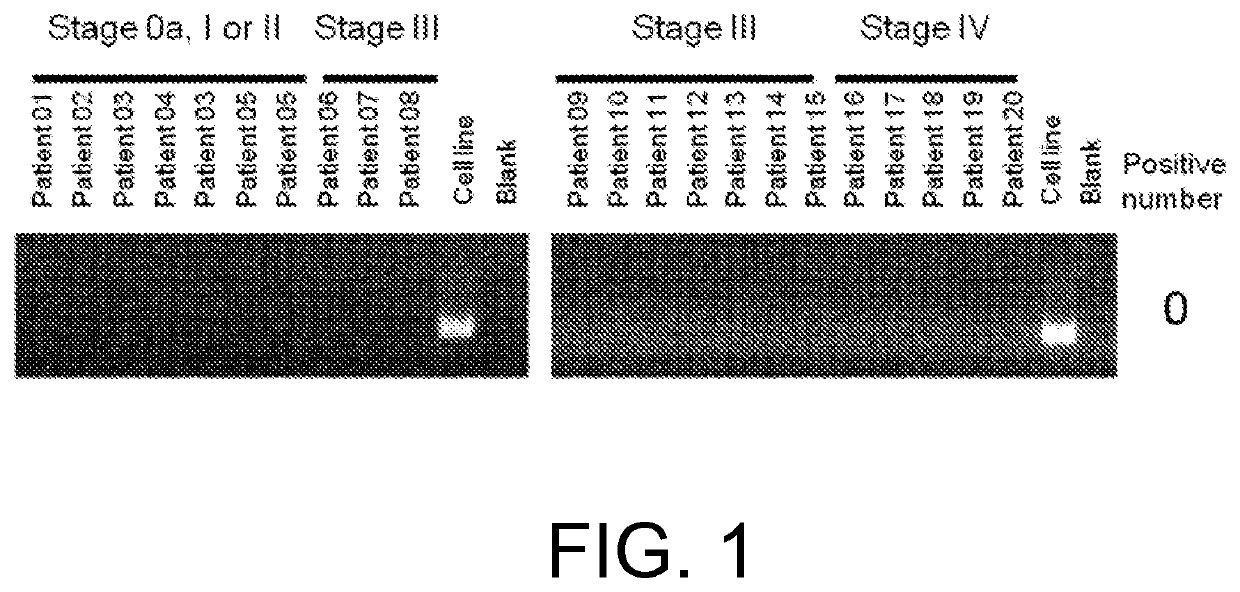 FGFR3 fusion gene and pharmaceutical drug targeting same