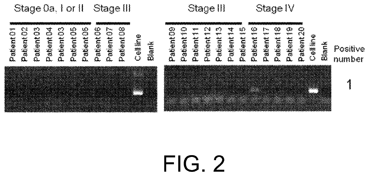 FGFR3 fusion gene and pharmaceutical drug targeting same