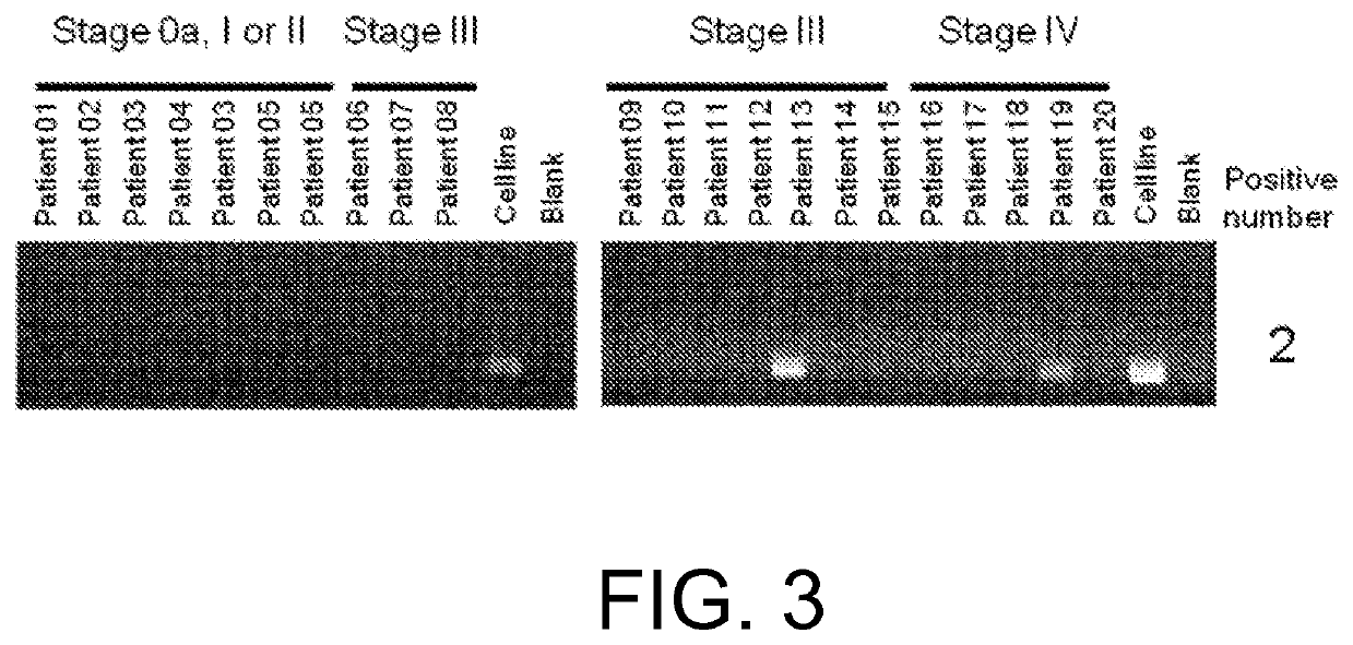 FGFR3 fusion gene and pharmaceutical drug targeting same