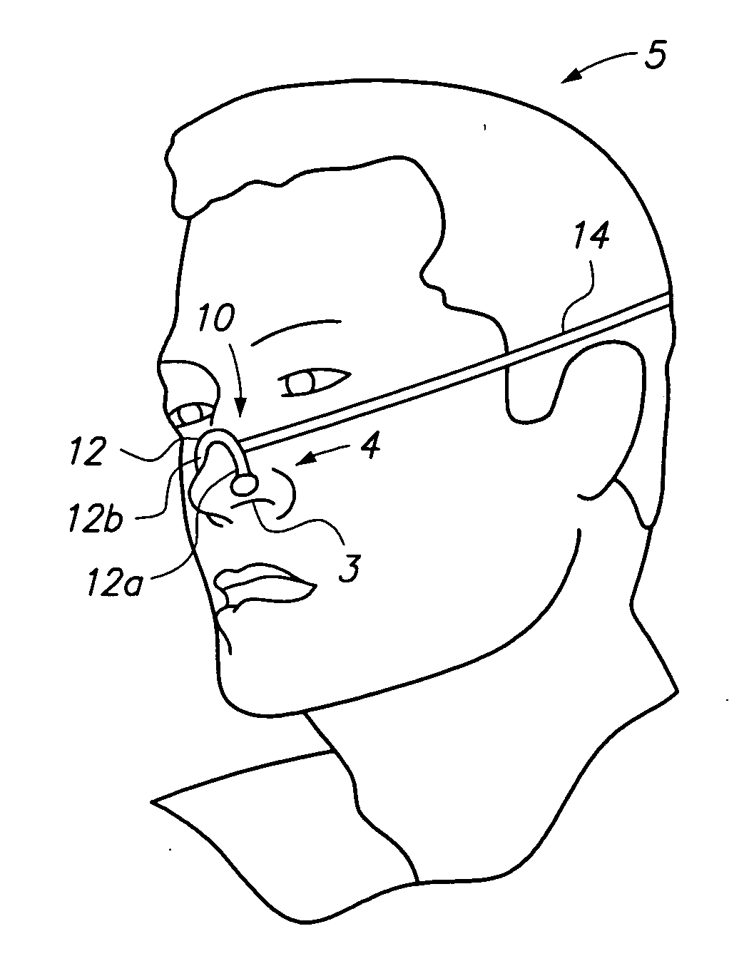 Method and device for treating bruxism while sleeping