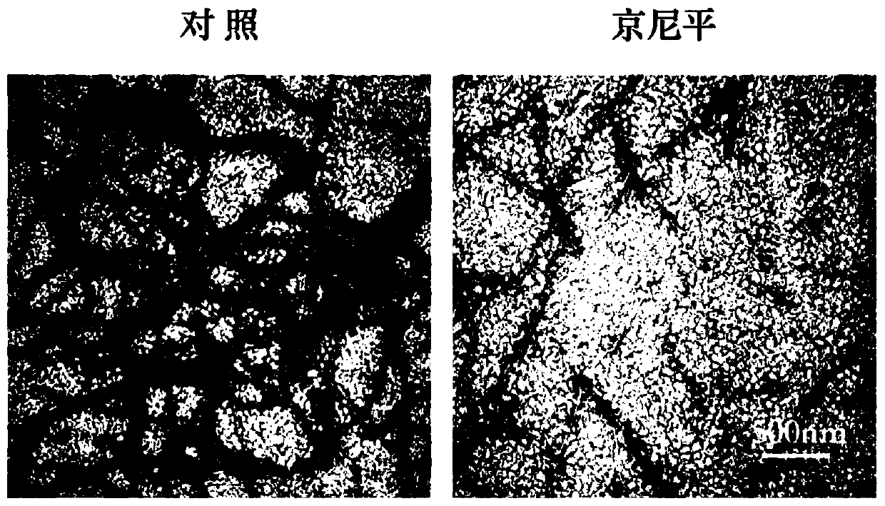 Novel application of genipin and discloses application of genipin in preparation of drug for preventing and treating Tau protein abnormality