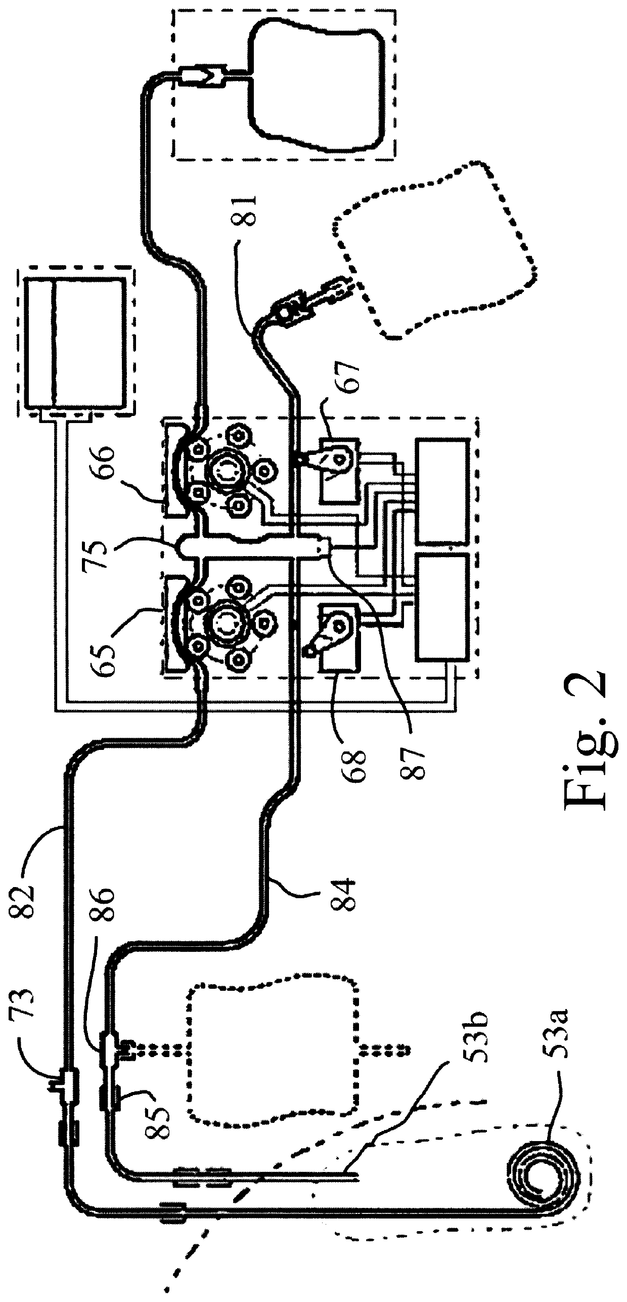 Method and apparatus for performing peritoneal ultrafiltration