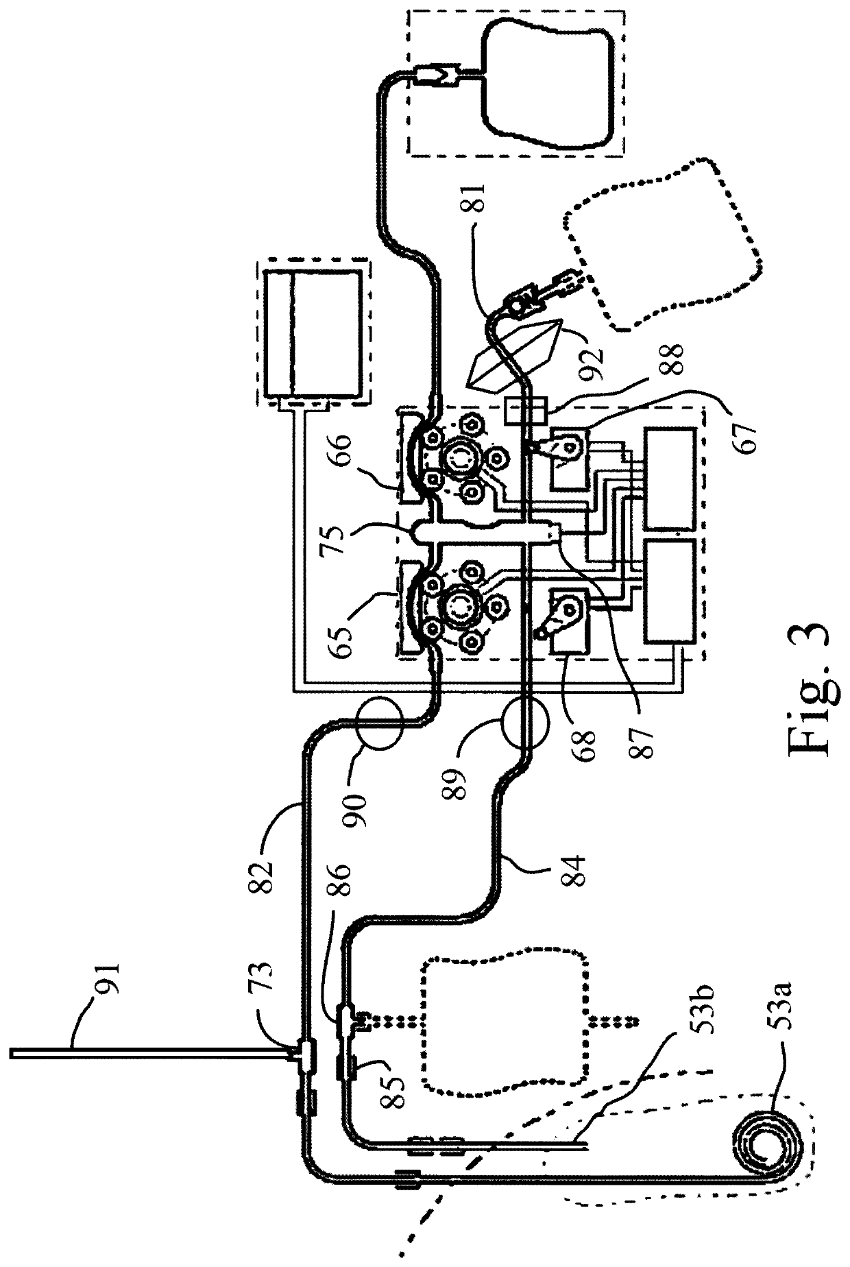 Method and apparatus for performing peritoneal ultrafiltration