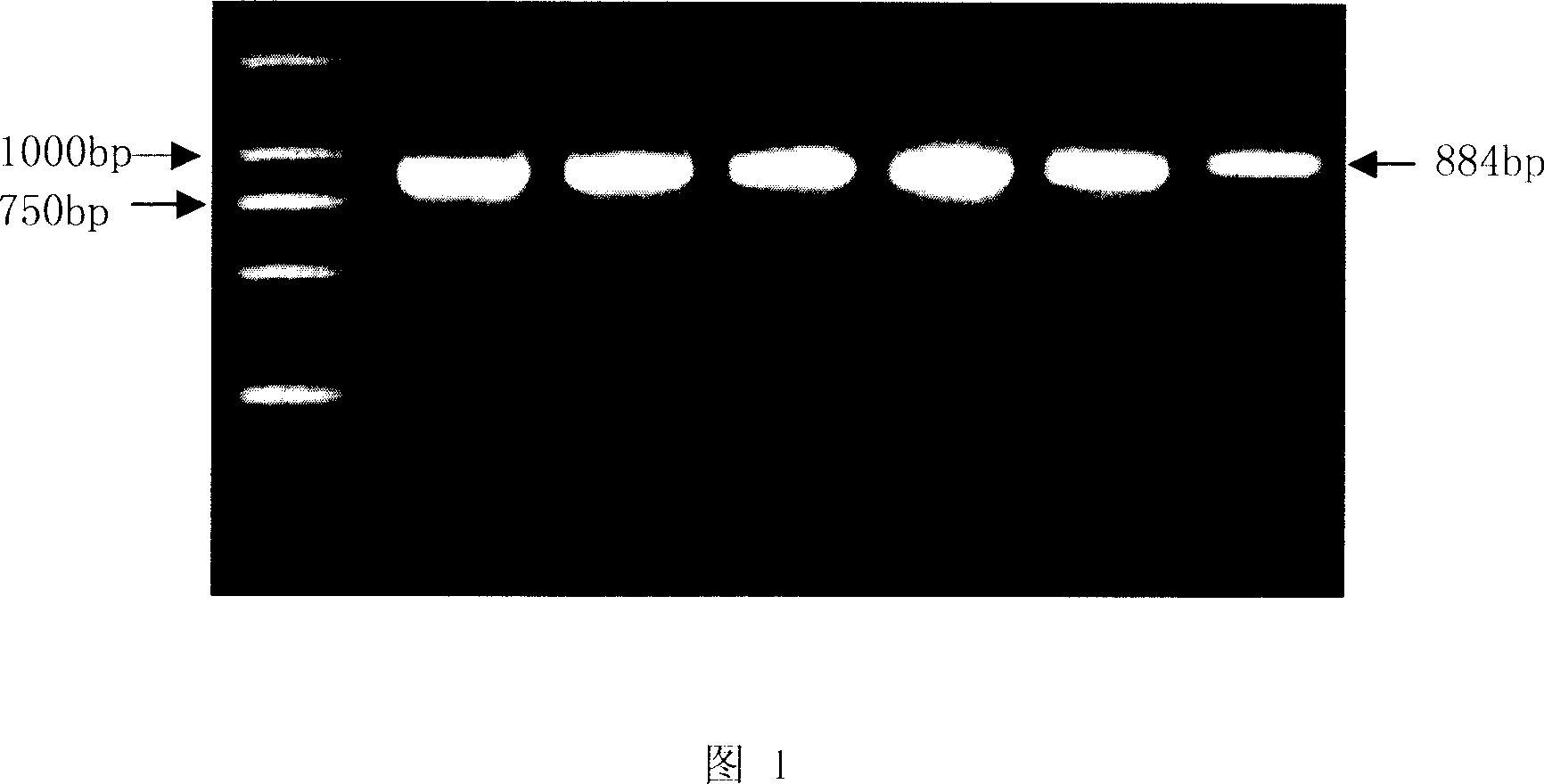 Beta-lactamase SHV gene variation detecting chip and application thereof