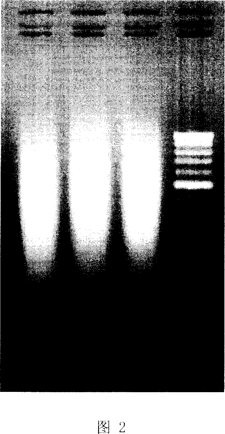 Beta-lactamase SHV gene variation detecting chip and application thereof