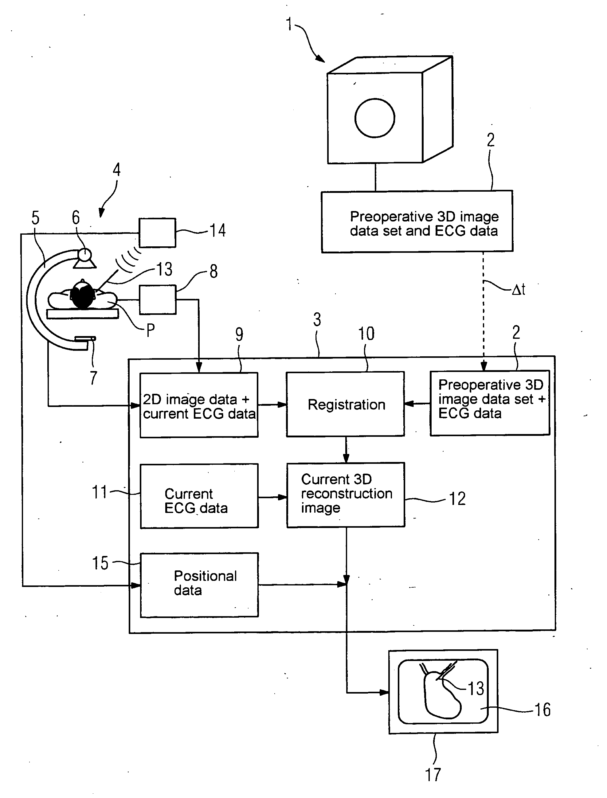 Method for medical imaging