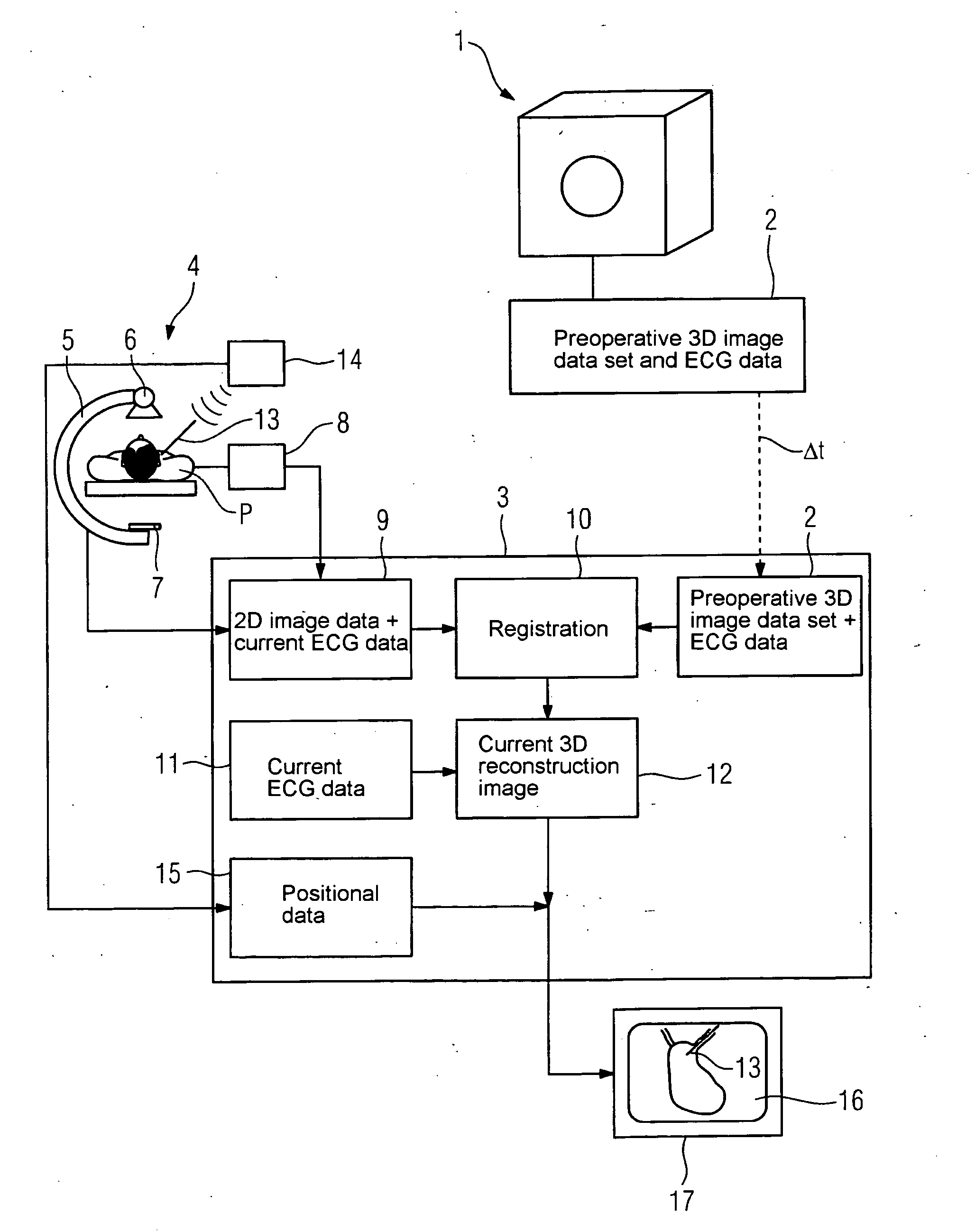 Method for medical imaging