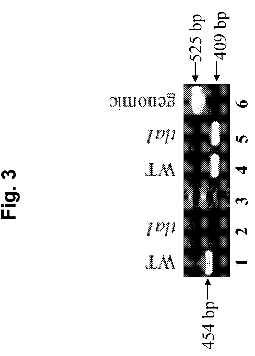 Suppression of <i>Tla1 </i>gene expression for improved solar conversion efficiency and photosynthetic productivity in plants and algae